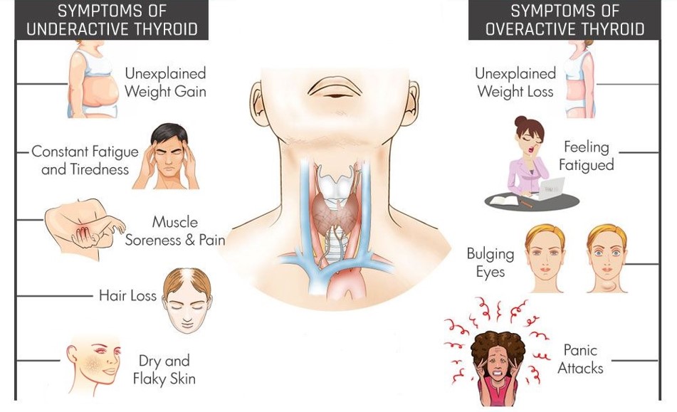 thyroid related disease